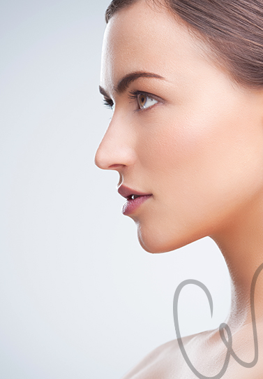 Rinoplastia