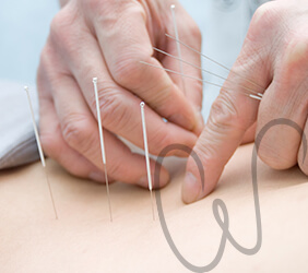 constante-valler-tratamento-corporal-acupuntura-thumb