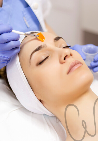 Clareamento de manchas – Peeling