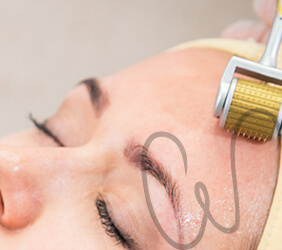 constante-valler-tratamento -facial-microagulhamento-thumb